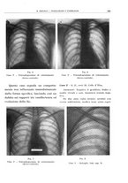 giornale/TO00191959/1941/unico/00000243