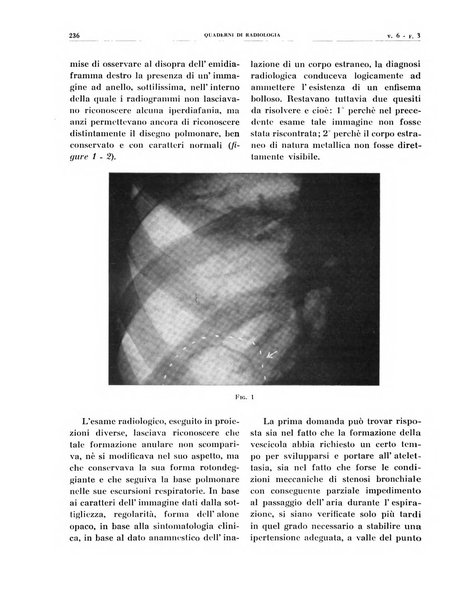 Quaderni di radiologia rivista di collaborazione clinico-radiologica fondata da M. Lapenna