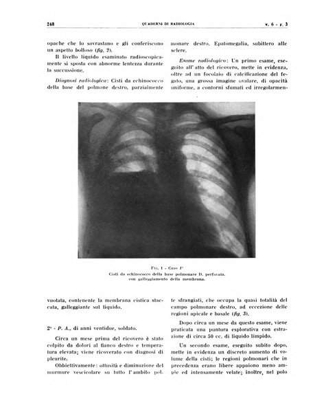 Quaderni di radiologia rivista di collaborazione clinico-radiologica fondata da M. Lapenna