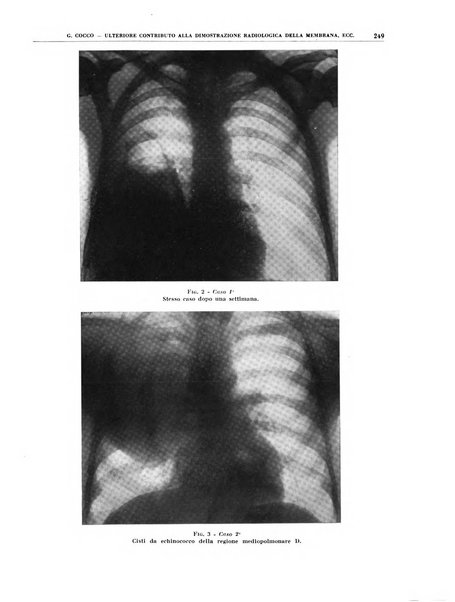 Quaderni di radiologia rivista di collaborazione clinico-radiologica fondata da M. Lapenna