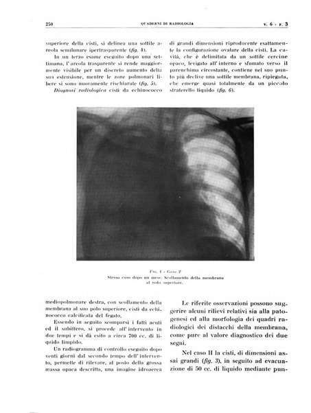 Quaderni di radiologia rivista di collaborazione clinico-radiologica fondata da M. Lapenna