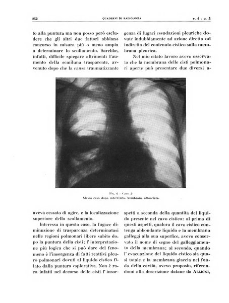 Quaderni di radiologia rivista di collaborazione clinico-radiologica fondata da M. Lapenna