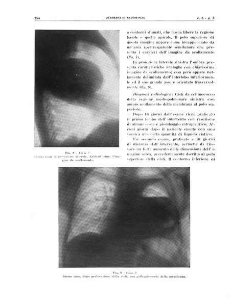 Quaderni di radiologia rivista di collaborazione clinico-radiologica fondata da M. Lapenna