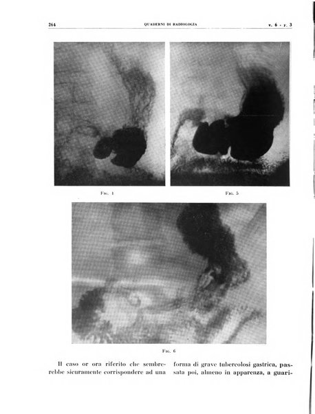 Quaderni di radiologia rivista di collaborazione clinico-radiologica fondata da M. Lapenna