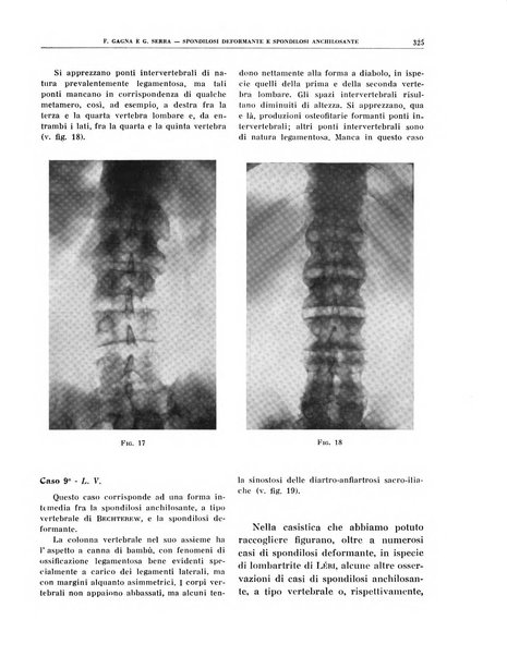 Quaderni di radiologia rivista di collaborazione clinico-radiologica fondata da M. Lapenna