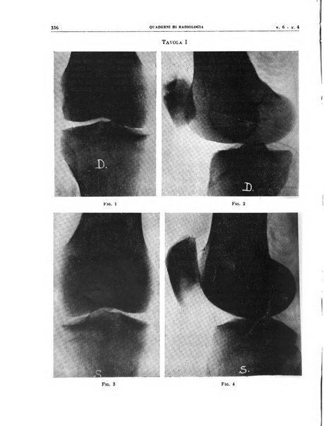 Quaderni di radiologia rivista di collaborazione clinico-radiologica fondata da M. Lapenna