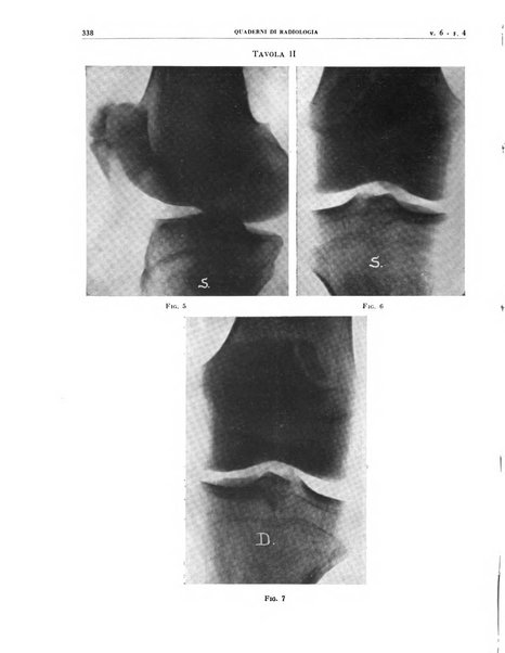 Quaderni di radiologia rivista di collaborazione clinico-radiologica fondata da M. Lapenna