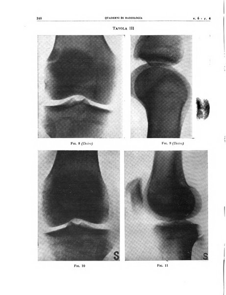 Quaderni di radiologia rivista di collaborazione clinico-radiologica fondata da M. Lapenna