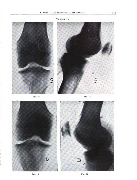 Quaderni di radiologia rivista di collaborazione clinico-radiologica fondata da M. Lapenna