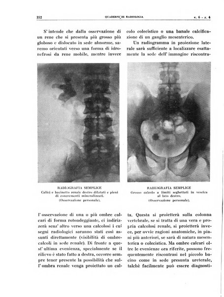 Quaderni di radiologia rivista di collaborazione clinico-radiologica fondata da M. Lapenna