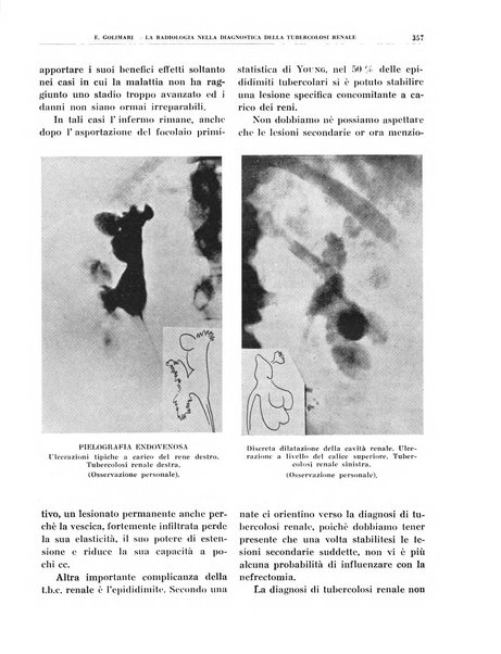 Quaderni di radiologia rivista di collaborazione clinico-radiologica fondata da M. Lapenna