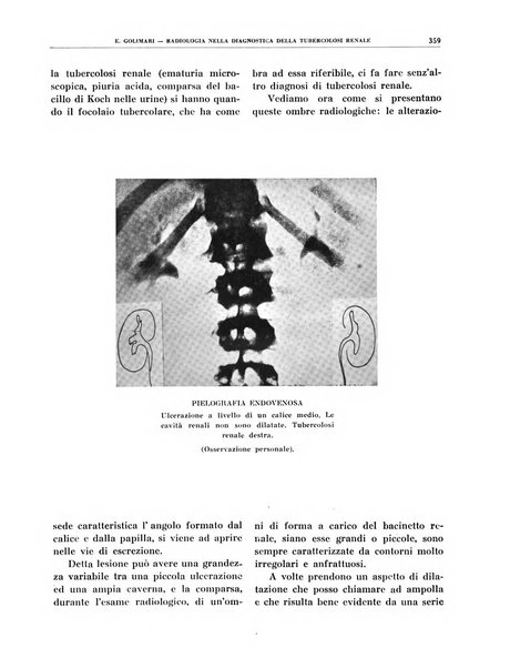 Quaderni di radiologia rivista di collaborazione clinico-radiologica fondata da M. Lapenna