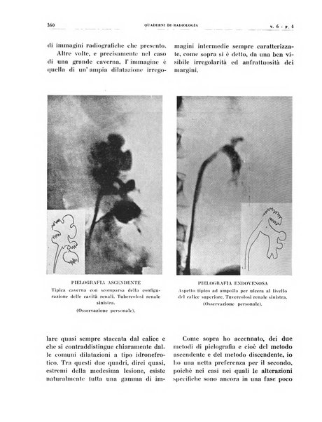 Quaderni di radiologia rivista di collaborazione clinico-radiologica fondata da M. Lapenna