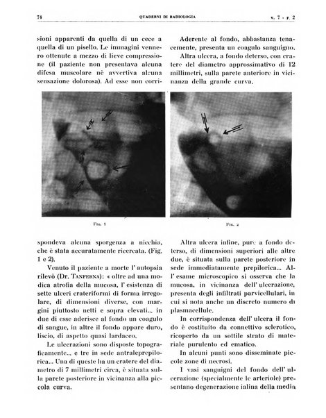 Quaderni di radiologia rivista di collaborazione clinico-radiologica fondata da M. Lapenna