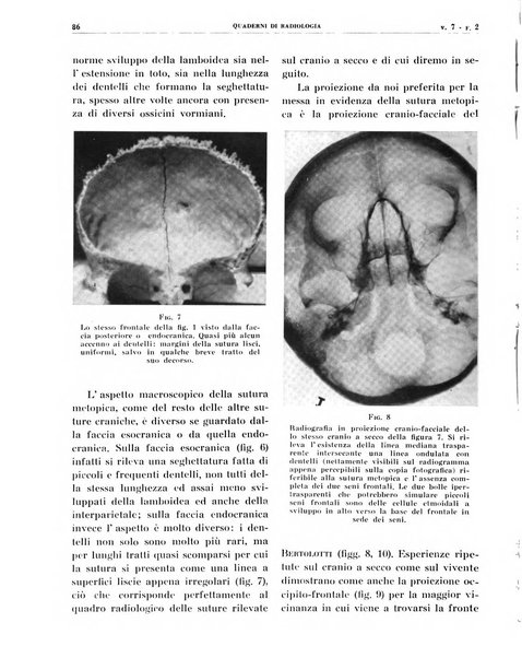 Quaderni di radiologia rivista di collaborazione clinico-radiologica fondata da M. Lapenna