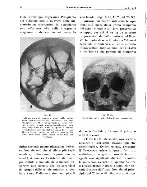 Quaderni di radiologia rivista di collaborazione clinico-radiologica fondata da M. Lapenna