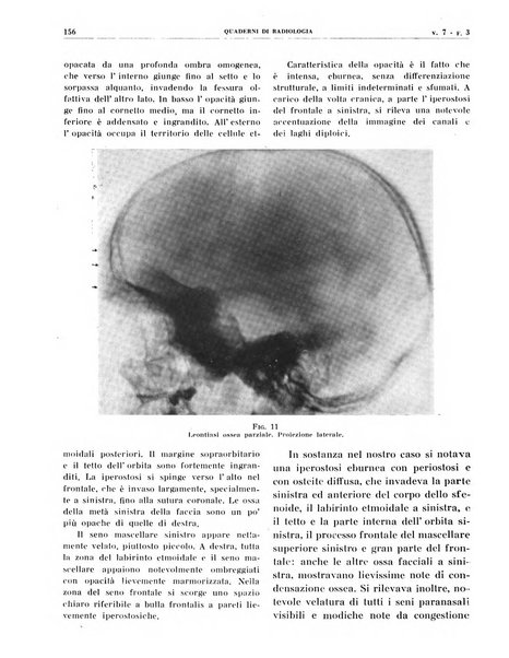 Quaderni di radiologia rivista di collaborazione clinico-radiologica fondata da M. Lapenna