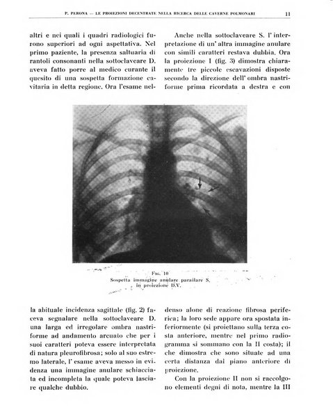 Quaderni di radiologia rivista di collaborazione clinico-radiologica fondata da M. Lapenna