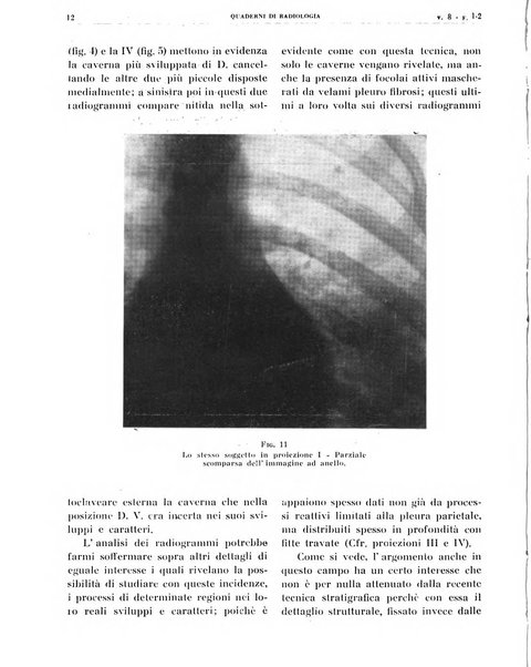 Quaderni di radiologia rivista di collaborazione clinico-radiologica fondata da M. Lapenna