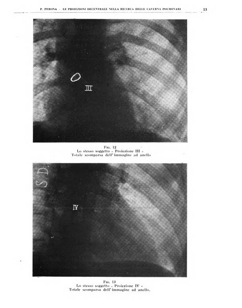 Quaderni di radiologia rivista di collaborazione clinico-radiologica fondata da M. Lapenna