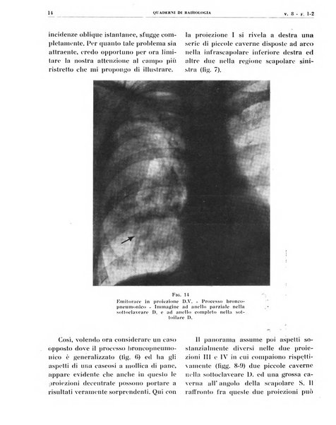 Quaderni di radiologia rivista di collaborazione clinico-radiologica fondata da M. Lapenna