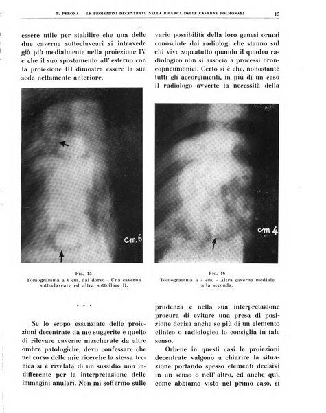 Quaderni di radiologia rivista di collaborazione clinico-radiologica fondata da M. Lapenna