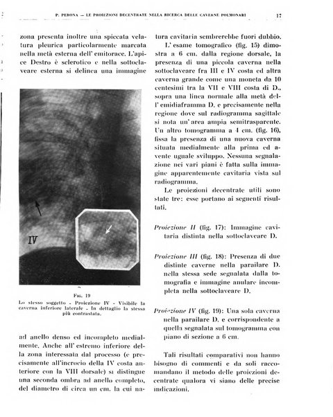 Quaderni di radiologia rivista di collaborazione clinico-radiologica fondata da M. Lapenna