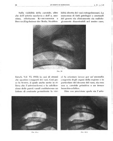 Quaderni di radiologia rivista di collaborazione clinico-radiologica fondata da M. Lapenna