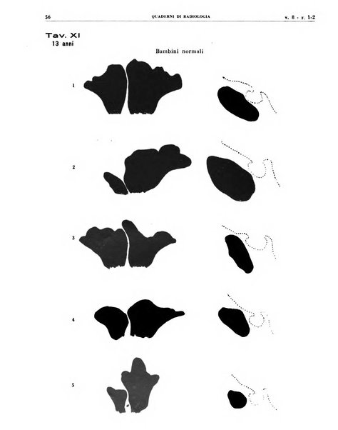 Quaderni di radiologia rivista di collaborazione clinico-radiologica fondata da M. Lapenna