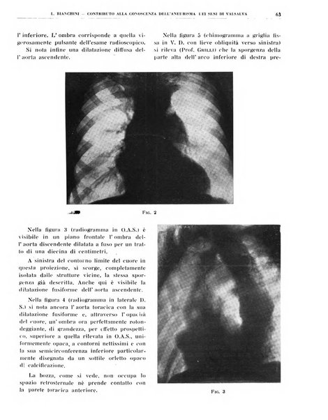 Quaderni di radiologia rivista di collaborazione clinico-radiologica fondata da M. Lapenna