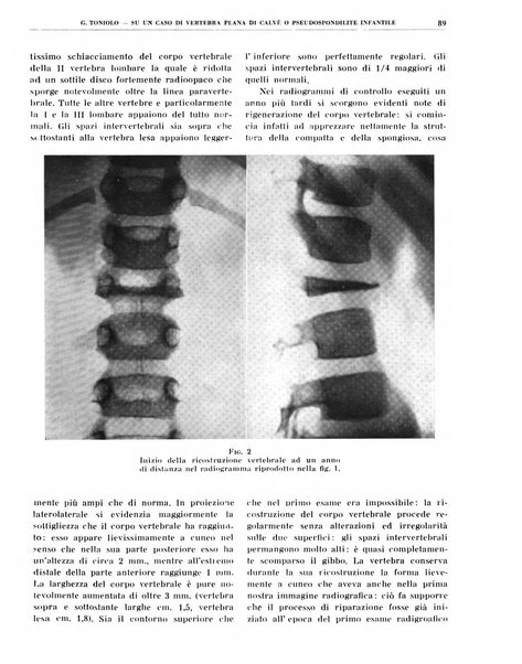 Quaderni di radiologia rivista di collaborazione clinico-radiologica fondata da M. Lapenna