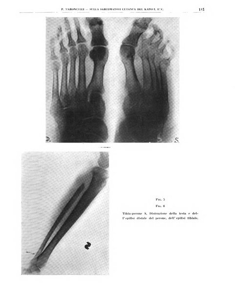 Quaderni di radiologia rivista di collaborazione clinico-radiologica fondata da M. Lapenna