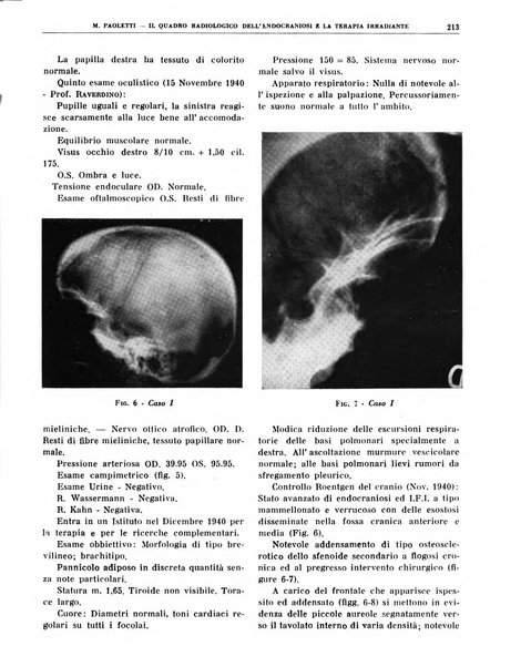 Quaderni di radiologia rivista di collaborazione clinico-radiologica fondata da M. Lapenna