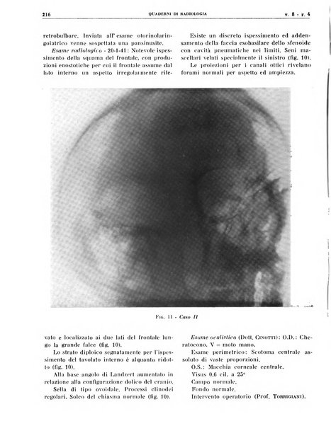 Quaderni di radiologia rivista di collaborazione clinico-radiologica fondata da M. Lapenna