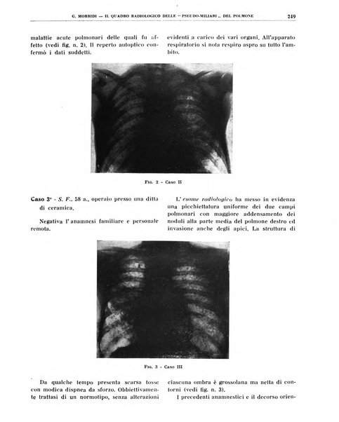 Quaderni di radiologia rivista di collaborazione clinico-radiologica fondata da M. Lapenna