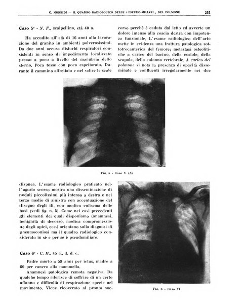 Quaderni di radiologia rivista di collaborazione clinico-radiologica fondata da M. Lapenna