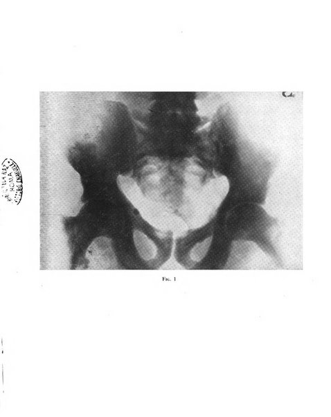 Quaderni di radiologia rivista di collaborazione clinico-radiologica fondata da M. Lapenna