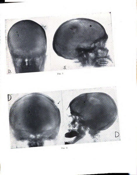 Quaderni di radiologia rivista di collaborazione clinico-radiologica fondata da M. Lapenna