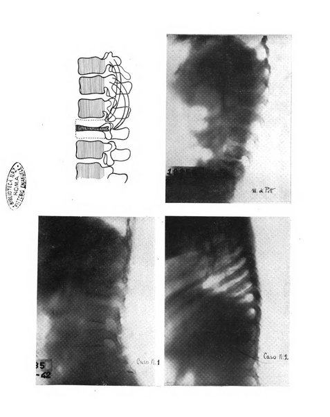 Quaderni di radiologia rivista di collaborazione clinico-radiologica fondata da M. Lapenna