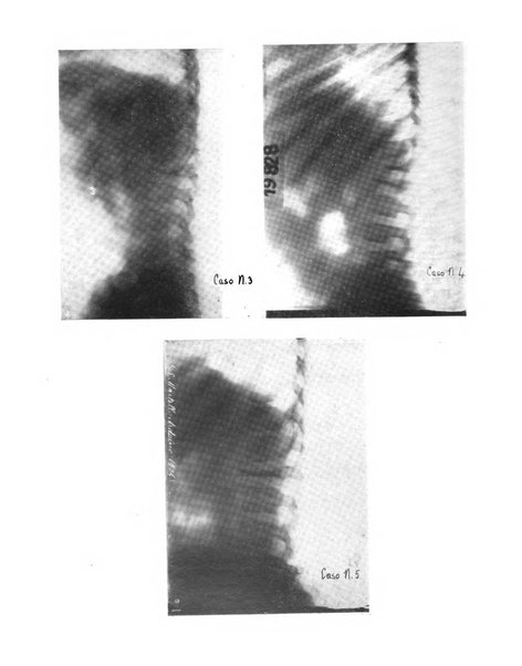 Quaderni di radiologia rivista di collaborazione clinico-radiologica fondata da M. Lapenna