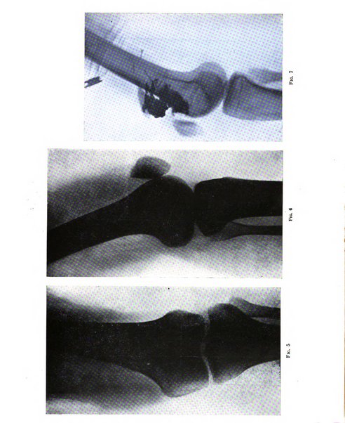 Quaderni di radiologia rivista di collaborazione clinico-radiologica fondata da M. Lapenna