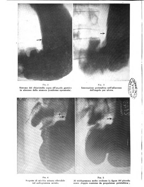 Quaderni di radiologia rivista di collaborazione clinico-radiologica fondata da M. Lapenna