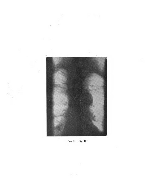 Quaderni di radiologia rivista di collaborazione clinico-radiologica fondata da M. Lapenna