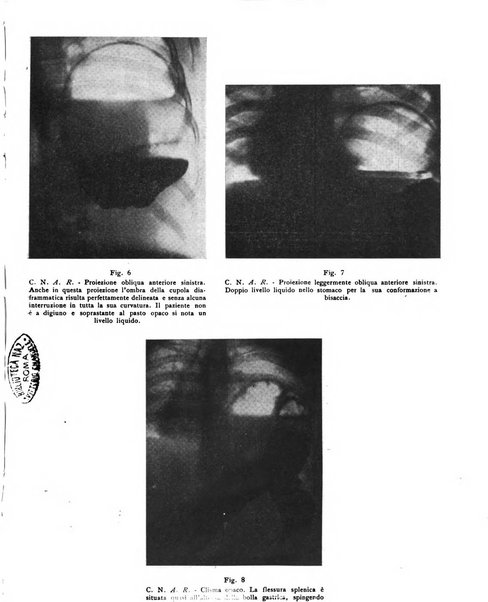 Quaderni di radiologia rivista di collaborazione clinico-radiologica fondata da M. Lapenna