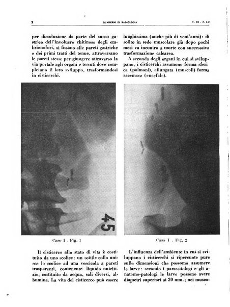 Quaderni di radiologia rivista di collaborazione clinico-radiologica fondata da M. Lapenna