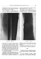 giornale/TO00191959/1945-1946/unico/00000019