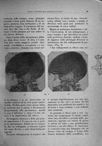 giornale/TO00191959/1945-1946/unico/00000065