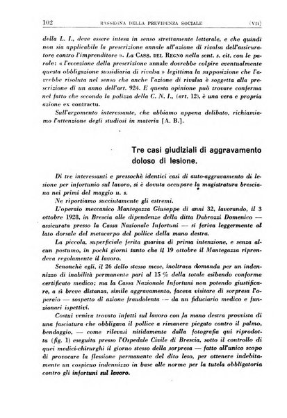 Rassegna della previdenza sociale assicurazioni e legislazione sociale, infortuni e igiene del lavoro