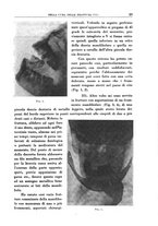 giornale/TO00192282/1931/V.18.1/00000141