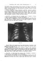 giornale/TO00192320/1932/v.3/00000021